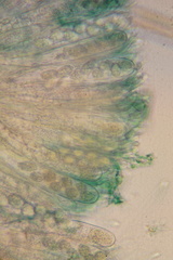 Mniaecia jungermanniae