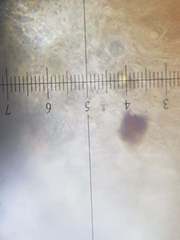 Pannaria implexa