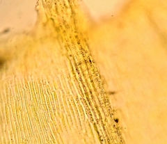 Mniodendron colensoi