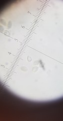 Pannaria implexa