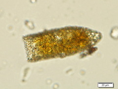 Tintinnopsis