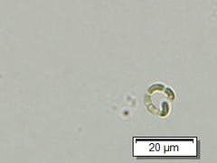 Stichococcus irregularis