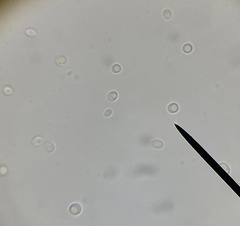 Staphylococcus aureus