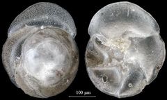 Rosalina columbiensis