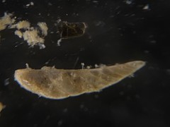 Vaginulina