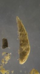 Vaginulina