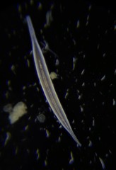 Hyalinonetrion elongatum