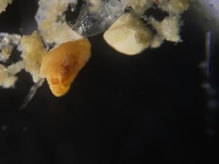 Glomospira gordialis