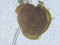 Glomospira gordialis