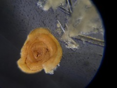 Glomospira gordialis