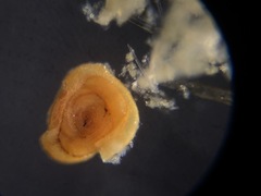 Glomospira gordialis
