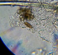 Sphaerulina westendorpii