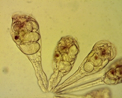 Conochilus unicornis