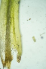 Dicranum acutifolium