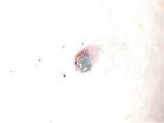 Ixodidae