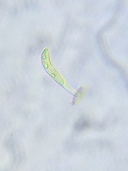 Stigeoclonium