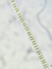 Hyalotheca