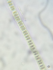 Hyalotheca