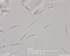 Synnemasporella aculeans