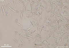 Synnemasporella aculeans