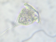 Vorticella campanula