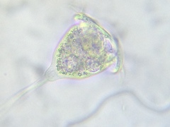 Vorticella campanula