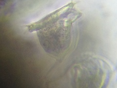 Vorticella campanula