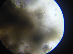 Vorticella campanula