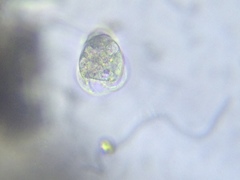 Vorticella campanula