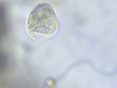 Vorticella campanula