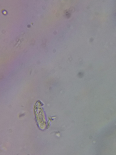 Dasyscyphella image