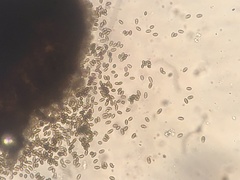 Chaenothecopsis savonica