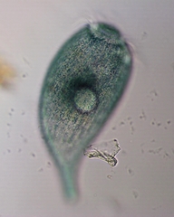 Stentor multiformis