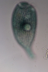 Stentor multiformis