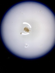 Thinoseius brevisternalis