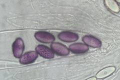 Ascobolus dadei