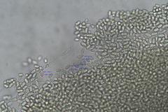 Pilobolus crystallinus