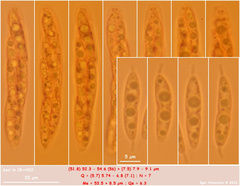 Synnemasporella aculeans