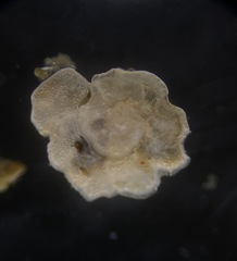 Cibicididae