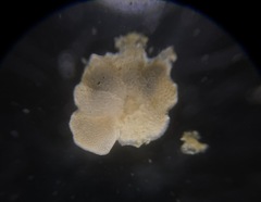 Cibicididae