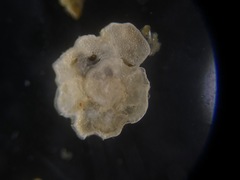 Cibicididae