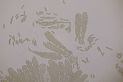 Cryptovalsa protracta