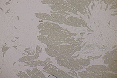 Cryptovalsa protracta