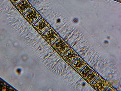 Hyalotheca
