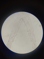 Stenothoidae