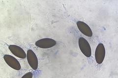 Podospora decipiens