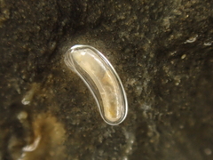 Caecum