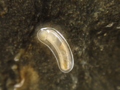 Caecum