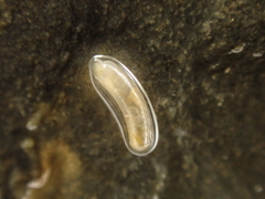 Caecum
