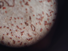 Arthonia rubrocincta